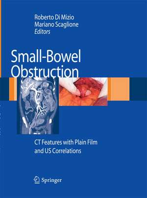 Small-Bowel Obstruction: CT Features with Plain Film and US correlations de Roberto Di Mizio