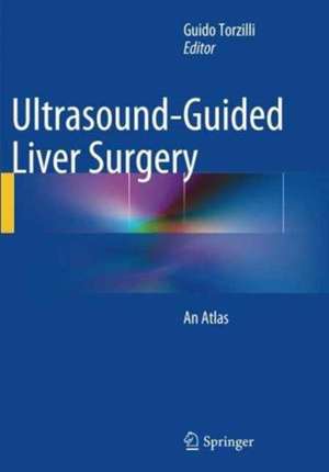 Ultrasound-Guided Liver Surgery: An Atlas de Guido Torzilli