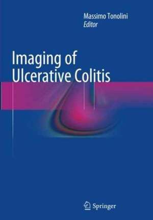 Imaging of Ulcerative Colitis de Massimo Tonolini