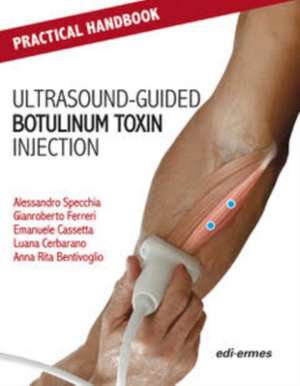 Practical Handbook for Ultrasound-guided Botulinum Toxin Inj