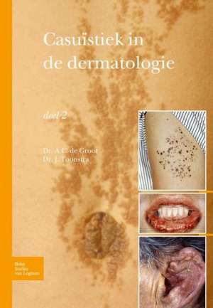 Casuïstiek in de dermatologie - deel 2 de Johan Toonstra