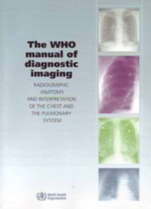 The WHO Manual of Diagnostic Imaging: Radiographic Anatomy and Interpretation of the Chest and the Pulmonary System de Stephen M. Ellis