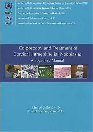 Colposcopy and Treatment of Cervical Intraepithelial Neoplasia: A Beginner's Manual