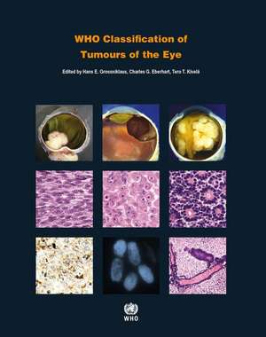 Who Classification of Tumours of the Eye de Who Classification of Tumours Editorial Board