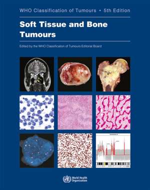 Soft Tissue and Bone Tumours de Who Classification of Tumours Editorial Board