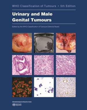 Urinary and Male Genital Tumours de Who Classification of Tumours Editorial Board