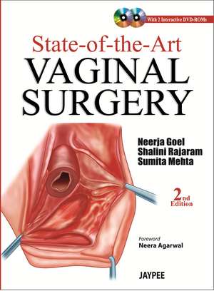 State-of-the-Art Vaginal Surgery de Sumita Mehta