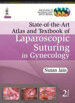 State-of-the-Art Atlas and Textbook of Laparoscopic Suturing in Gynecology de Nutan Jain