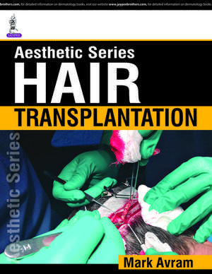 Aesthetic Series - Hair Transplantation de Marc R Avram