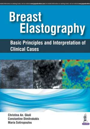 Breast Elastography: Basic Principles and Interpretation of Clinical Cases de Christina An Gkali