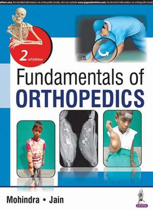 Fundamentals of Orthopedics de Mukul Mohindra