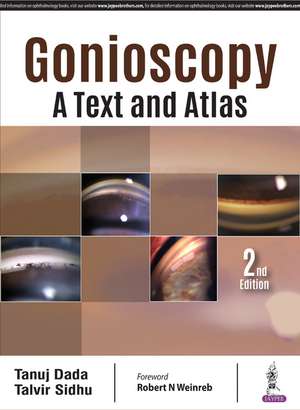 Gonioscopy: A Text and Atlas de Tanuj Dada