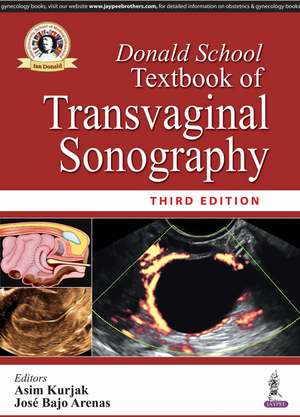 Donald School Textbook of Transvaginal Sonography de Asim Kurjak