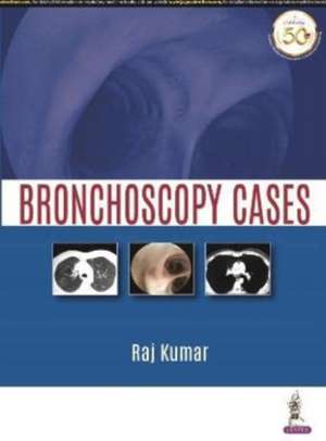 Bronchoscopy Cases de Raj Kumar