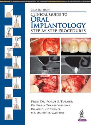 Clinical Guide to Oral Implantology: Step by Step Procedures de Porus S Turner