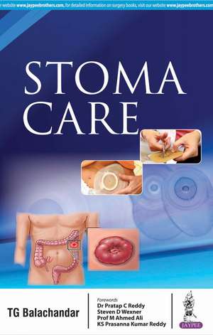 Stoma Care de TG Balachandar