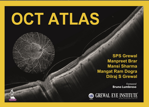 OCT Atlas de SPS Grewal