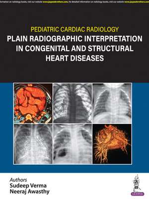 Pediatric Cardiac Radiology: Plain Radiographic Interpretation in Congenital and Structural Heart Diseases de Sudeep Verma