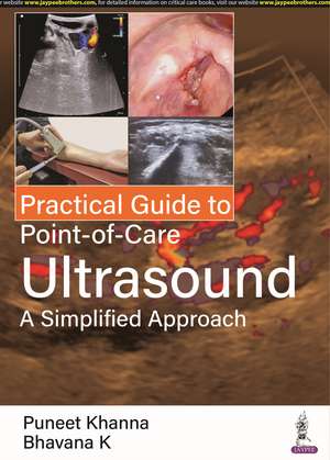 Practical Guide to Point-of-Care Ultrasound: A Simplified Approach de Puneet Khanna