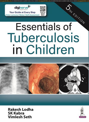 Essentials of Tuberculosis in Children de Rakesh Lodha