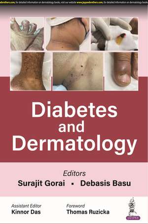 Diabetes and Dermatology de Surajit Gorai