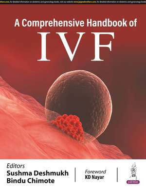 A Comprehensive Handbook of IVF de Sushma Deshmukh