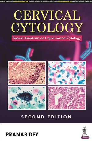 Cervical Cytology: Special Emphasis on Liquid-based Cytology de Pranab Dey