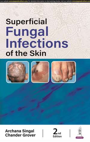 Superficial Fungal Infections of the Skin de Archana Singhal