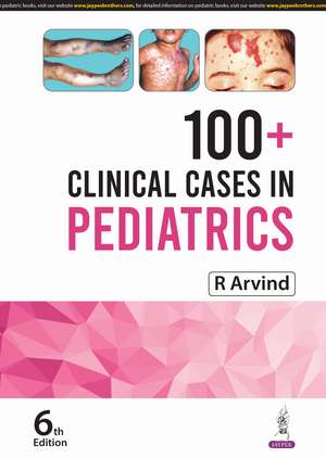 100+ Clinical Cases in Pediatrics de R Arvind