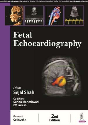 Fetal Echocardiography de Sejal Shah