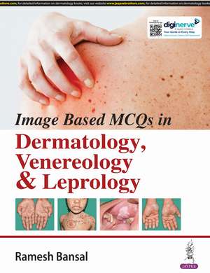 Image Based MCQs in Dermatology, Venereology & Leprology de Ramesh Bansal