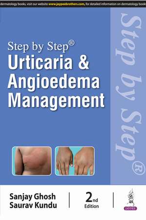 Step by Step: Urticaria & Angioedema Management de Sanjay Ghosh