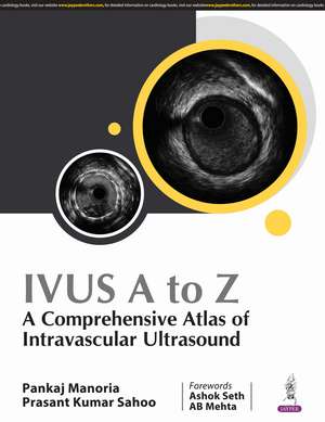 IVUS A to Z: A Comprehensive Atlas of Intravascular Ultrasound de Pankaj Manoria