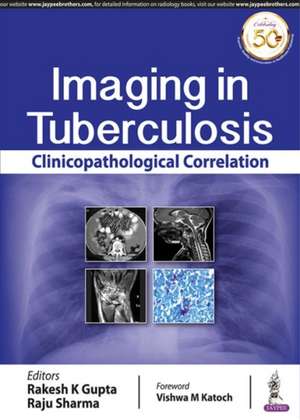 Imaging in Tuberculosis: Clinicopathological Correlation de Rakesh K Gupta