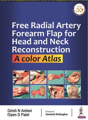 Free Radial Artery Forearm Flap for Head and Neck Reconstruction: A Color Atlas de Girish N Amlani