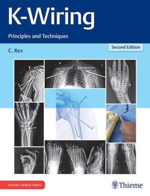 K–Wiring – Principles and Techniques de C. Rex