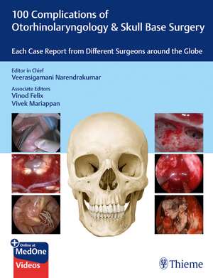 100 Complications of Otorhinolaryngology & Skull Base Surgery de Veerasigamani Narendrakumar