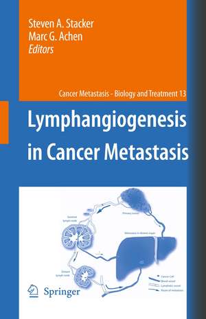 Lymphangiogenesis in Cancer Metastasis de Steven A. Stacker