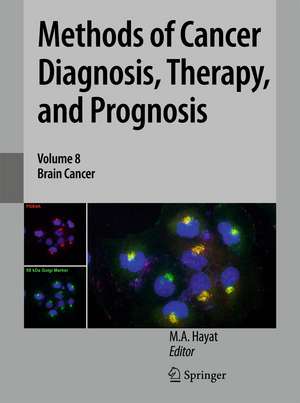 Methods of Cancer Diagnosis, Therapy, and Prognosis: Brain Cancer de M. A. Hayat