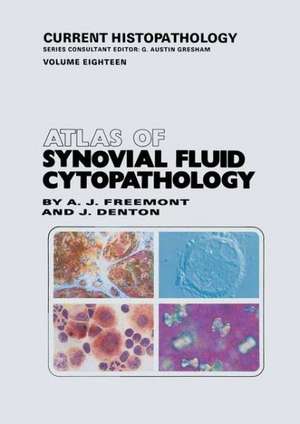 Atlas of Synovial Fluid Cytopathology de Anthony J. Freemont