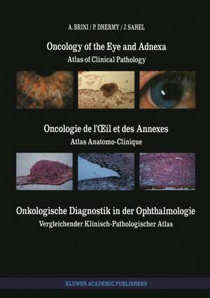 Oncology of the Eye and Adnexa / Oncologie de l’Œil et des Annexes / Onkologische Diagnostik in der Ophthalmologie: Atlas of Clinical Pathology / Atlas Anatomo-Clinique / Vergleichender Klinisch-Pathologischer Atlas de A. Brini