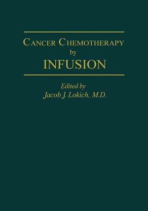 Cancer Chemotherapy by Infusion de J.J. Lokich