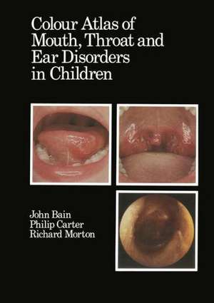 Colour Atlas of Mouth, Throat and Ear Disorders in Children de D.J. Bain