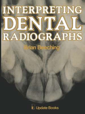 Interpreting Dental Radiographs de B.W. Beeching