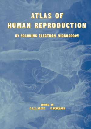 Atlas of Human Reproduction: By Scanning Electron Microscopy de E.S. Hafez