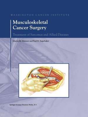 Musculoskeletal Cancer Surgery: Treatment of Sarcomas and Allied Diseases de Martin M. Malawer