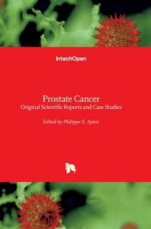 Prostate Cancer de Philippe E. Spiess