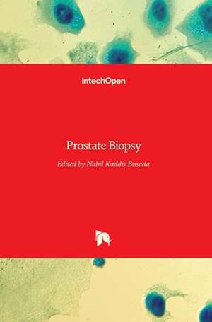 Prostate Biopsy de Nabil K. Bissada