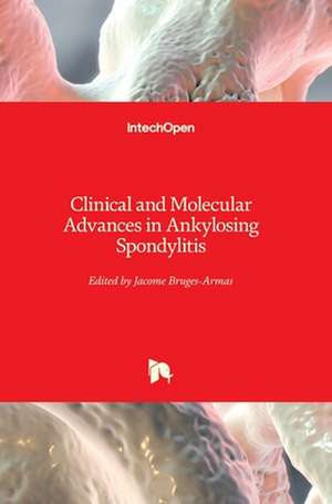 Clinical and Molecular Advances in Ankylosing Spondylitis de Jacome Bruges-Armas