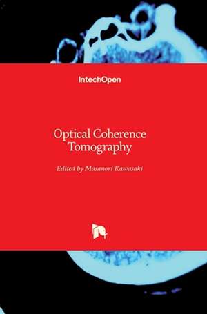 Optical Coherence Tomography de Masanori Kawasaki